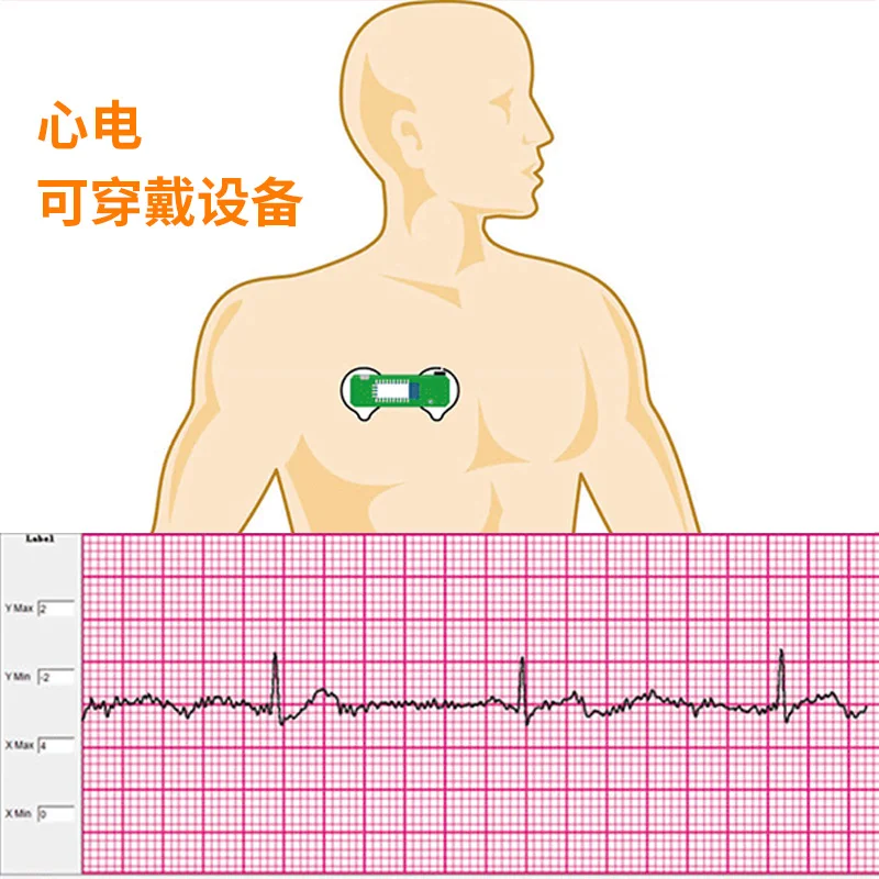 BMD101 ECG Electrocardiogram S - Ecg Patch Monitor review and price